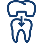 Same-Day Crowns (CEREC)