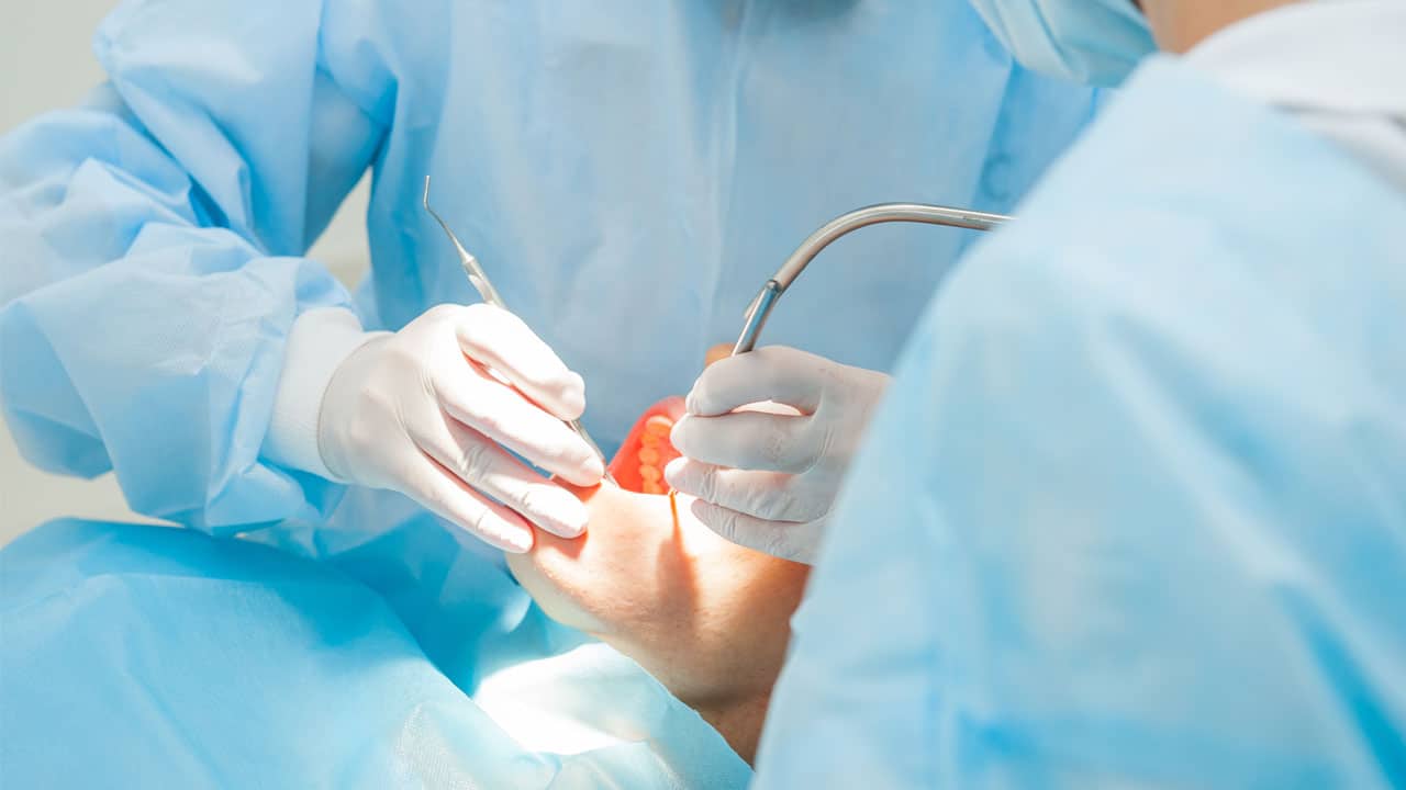 Oral surgery